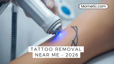 Laser tattoo removal procedure at a modern clinic – tattoo removal near me 2026